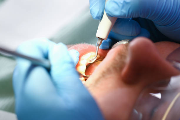 Best Broken or Cracked Tooth Emergency Dentist in Rowland Heights, CA
